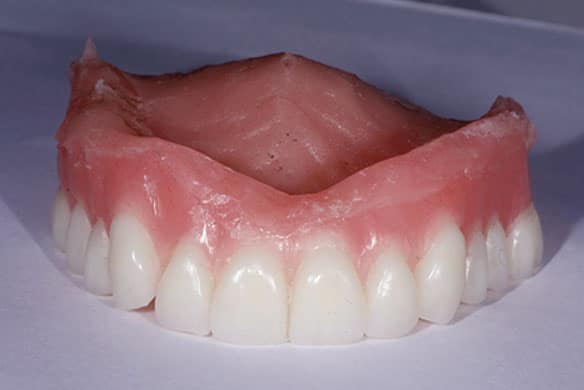img-Upper-Denture