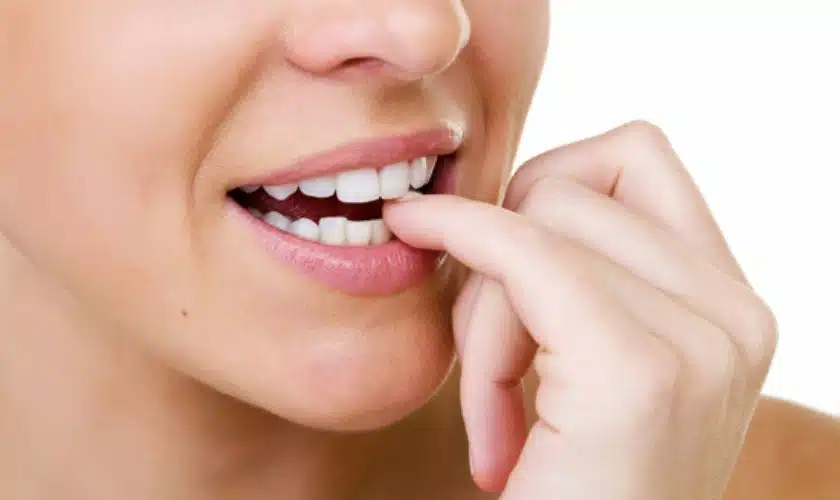 Onychophagia, the habit of biting your nails – Alvarado Dental Clinic